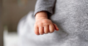 newborn health check at home newborn jaundice monitoring infant care support Dubai